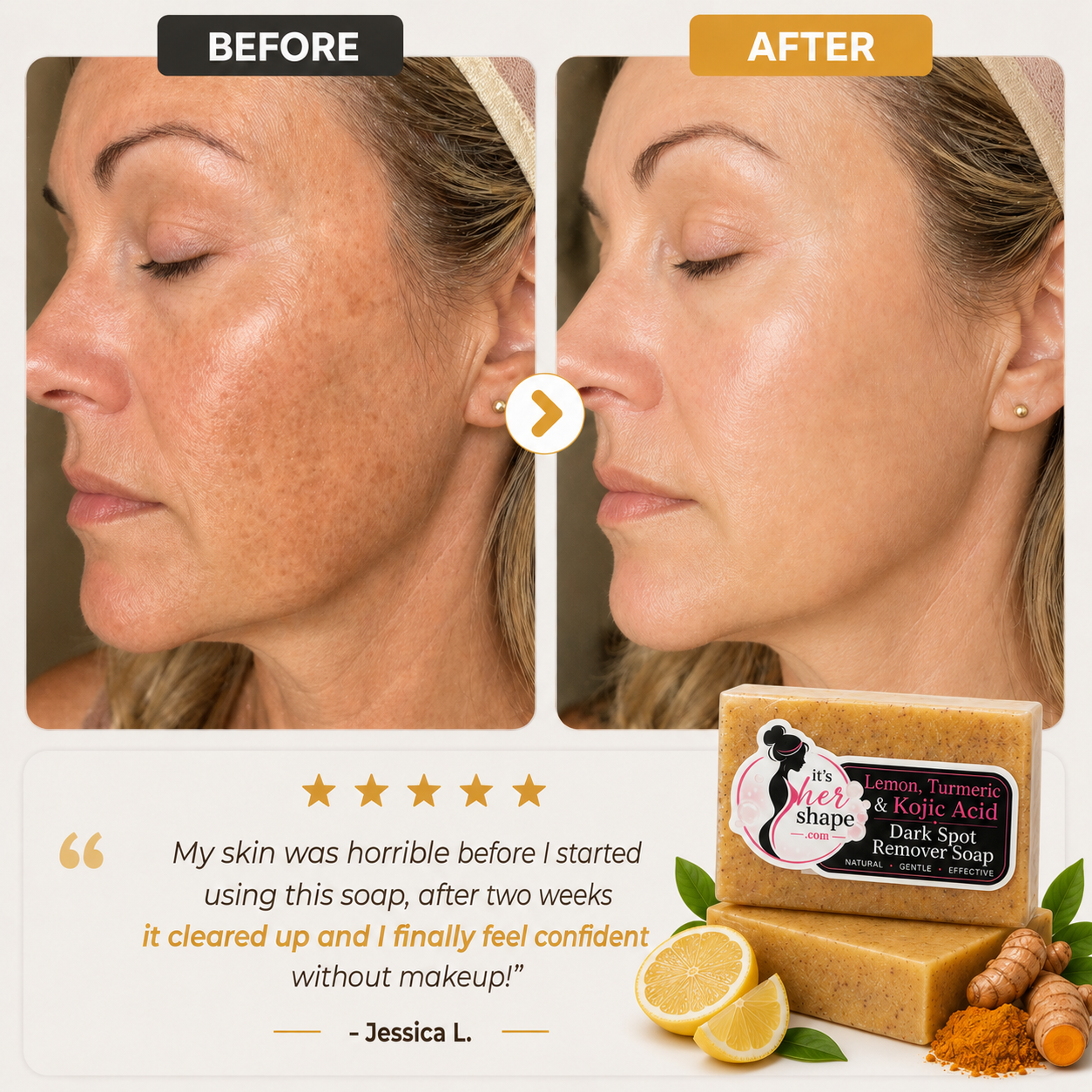 Lemon Turmeric Kojic Soap Bar