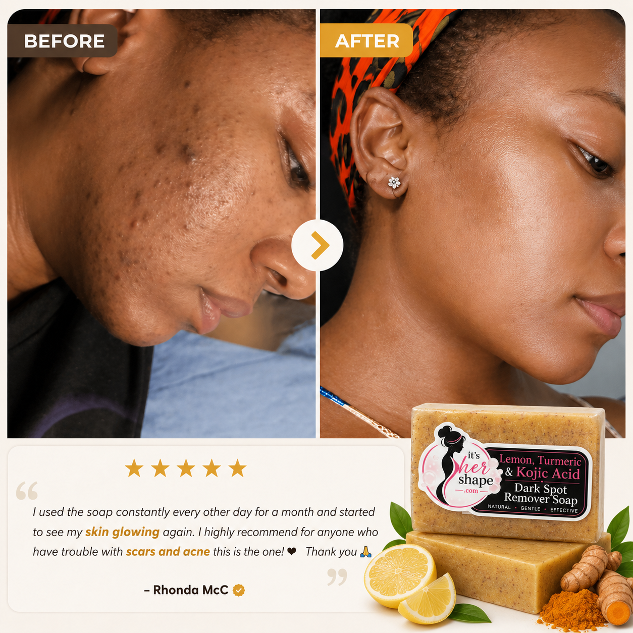 Lemon Turmeric Kojic Soap Bar