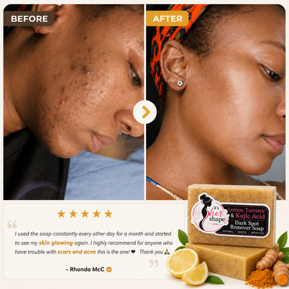 Lemon Turmeric Kojic Soap Bar
