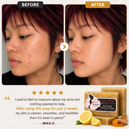 Lemon Turmeric Kojic Soap Bar
