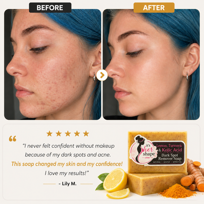 Lemon Turmeric Kojic Soap Bar